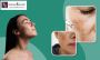Effective Melasma Treatment in Bangalore 
