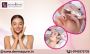 Best Uneven Skin Tone Treatment in Bangalore