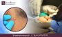 Affordable Sebaceous Cyst Removal Cost in Bangalore
