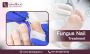 Effective Fungus Nail Treatment in Bangalore