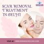 Get Rid of Scars with Expert Treatments at DermaSure Clinic 
