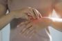 How to Relieve Eczema Symptoms Naturally