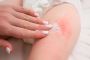 How can I find the best eczema treatment for sensitive skin?
