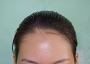 Can Sunscreens for Oily Skin Be Used Under Makeup