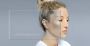 What Are the Types of Pigmentation and Their Treatments?