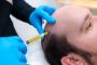 The Safety and Effectiveness of PRP Treatment