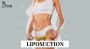 Transform Your Body with Expert Liposuction in India
