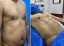 Transform Your Body with 4D High-Definition Contouring: Achi