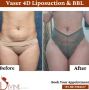 Sculpted Thighs & Perfect Buttock: Reshape Your Body