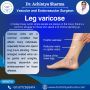 Understanding Varicose Veins Symptoms: What You Need to Know