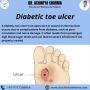 How to Heal a Diabetic Ulcer on the Toe: Key Insights