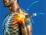 Get Back in Motion: Arthroscopy Surgery Delhi