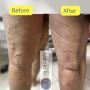 ExperiencedVascularSurgeoninMumbai,India-Dr. Dharav Kheradia