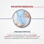 ProstateEnlargementTreatmentin Mumbai by Dr. Dharav Kheradia