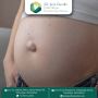 Hernia Surgery Made Simple with Dr. Jenit Gandhi