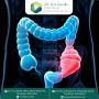 Best Colon Cancer Treatment in Ahmedabad, India – Book Your 