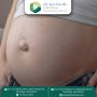 Dr. Jenit Gandhi – Best Robotic Hernia Surgeon in Ahmedabad