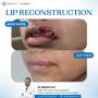 Best Plastic Surgeon in Lucknow | Dr. Nikhil Puri