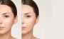 What Is Ear Pinning and What Does It Do?