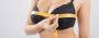 Procedure of Breast Reduction in Delhi