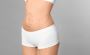 High-Definition Liposuction: Sculpt Your Body with Precision