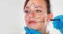 Facelift Surgery Cost In Delhi - Dr Rajat Gupta