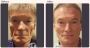 What Is the Best Facial Rejuvenation Treatment?