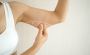 What You Need to Know About Arm Lift Surgery?