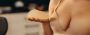 Importance of Size and Proportion in Breast Augmentation