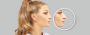 Why Celebrity Nose Jobs Are So Popular: All You Need to Know