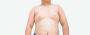Can Gynecomastia Come Back After Surgery?