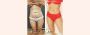 Tummy Tuck Surgery for Flat Belly That You Desire