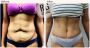 Liposuction Surgery in Delhi - Dr Rajat Gupta