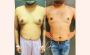 How to Lose Pectoral Fat in Men?