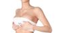 Breast lift surgery cost in Delhi - Dr Rajat Gupta