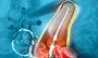 Cardiologists in Ahmedabad: Pioneers in Coronary Angioplasty