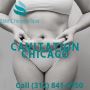 Cavitation Chicago