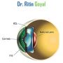 Best Clinic for ICL Surgery Delhi