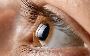 Advanced Cataract Surgery Now Available