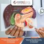 Best Gallbladder Stone Treatment in Ahmedabad – Specialist C