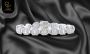 The Ultimate Guide to Stylish Lab-Grown Diamond Bracelets