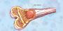 Navigating Bone Marrow Transplant Options in India