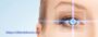 Choose the Best and Safe Laser Eye Treatment