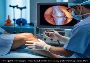 Knee Joint Arthroscopy
