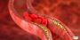 Sickle Treatment in India