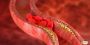 Thalassemia Treatment in India