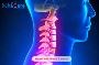Advanced & Affordable Head and Neck Cancer Treatment in Indi
