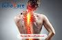 Best Pinched Nerve Treatment in India with Edhacare