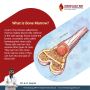 bone marrow transplant in Hyderabad | Dr. S.K.Gupta.