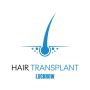 Hair Transplant Lucknow